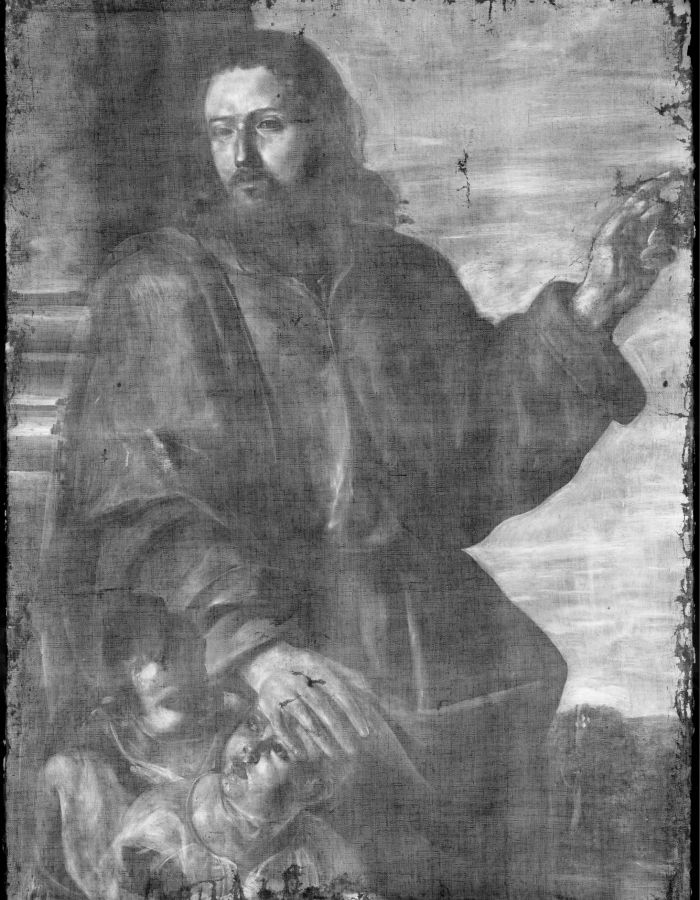 X-radiography – Full composition