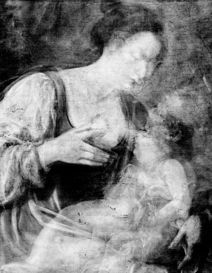 X-radiography – Detail A